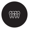 Orthodontic Braces